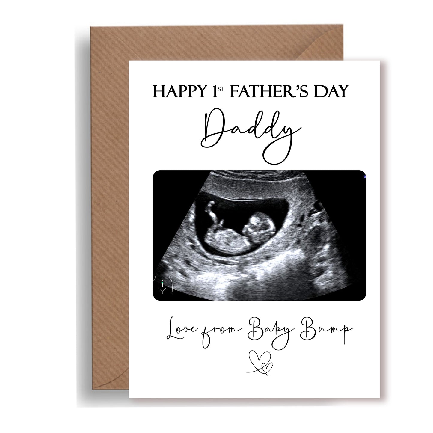 Happy First Father's Day Daddy' Card – From the Bump with Baby Scan Photo
